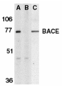 BACE1 / BACE Antibody - Western blot of BACE in human brain tissue lysate in the absence (A) or presence (B) of blocking peptide (2253P) and in mouse 3T3 cell lysate (C) with BACE antibody at 1 ug/ml.