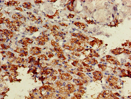 BACE1 / BACE Antibody - Immunohistochemistry of paraffin-embedded human adrenal gland tissue using BACE1 Antibody at dilution of 1:100