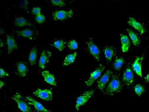 BACE1 / BACE Antibody - Immunofluorescent analysis of A549 cells using BACE1 Antibody at a dilution of 1:100 and Alexa Fluor 488-congugated AffiniPure Goat Anti-Rabbit IgG(H+L)