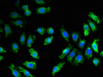 BACE1 / BACE Antibody - Immunofluorescent analysis of A549 cells using BACE1 Antibody at dilution of 1:100 and Alexa Fluor 488-congugated AffiniPure Goat Anti-Rabbit IgG(H+L)