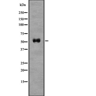 BACE1 / BACE Antibody - Western blot analysis of BACE1 using COLO205 whole lysates.