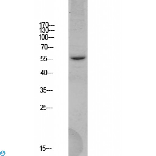 BACE1 / BACE Antibody - Western blot analysis of HEK293 lysate, antibody was diluted at 1000. Secondary antibody was diluted at 1:20000.