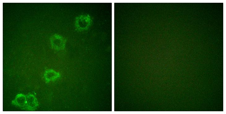 BACE1 / BACE Antibody - Peptide - + Immunofluorescence analysis of HuvEc cells, using BACE antibody.
