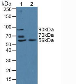 BACE2 Antibody - Western Blot; Sample: Lane1: Human Serum; Lane2: Human Hela Cells.