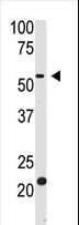 BACE2 Antibody - The anti-BACE2 Ctr antibody is used in Western blot to detect BACE2 in HL60 cell lysate.