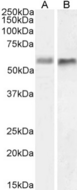 BACE2 Antibody - WB on HeLa and U251 cell lysates.
