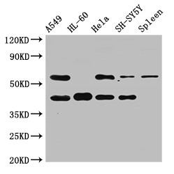 BACE2 Antibody - Positive WB detected in:A549 whole cell lysate,HL-60 whole cell lysate,Hela whole cell lysate,SH-SY5Y whole cell lysate,Rat spleen tissue;All lanes:BACE2 antibody at 2.5?g/ml;Secondary;Goat polyclonal to rabbit IgG at 1/50000 dilution;Predicted band size: 57,51,43,39,47 KDa;Observed band size: 57,43 KDa;