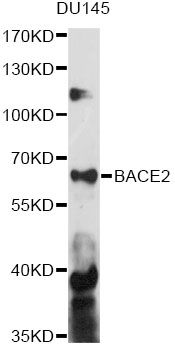 BACE2 Antibody - Western blot analysis of extracts of DU145 cells, using BACE2 antibody at 1:1000 dilution. The secondary antibody used was an HRP Goat Anti-Rabbit IgG (H+L) at 1:10000 dilution. Lysates were loaded 25ug per lane and 3% nonfat dry milk in TBST was used for blocking. An ECL Kit was used for detection and the exposure time was 90s.