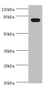 BACH1 Antibody - Western blot All lanes: BACH1 antibody at 2µg/ml + Mouse thymus tissue Secondary Goat polyclonal to rabbit IgG at 1/10000 dilution Predicted band size: 82 kDa Observed band size: 82 kDa