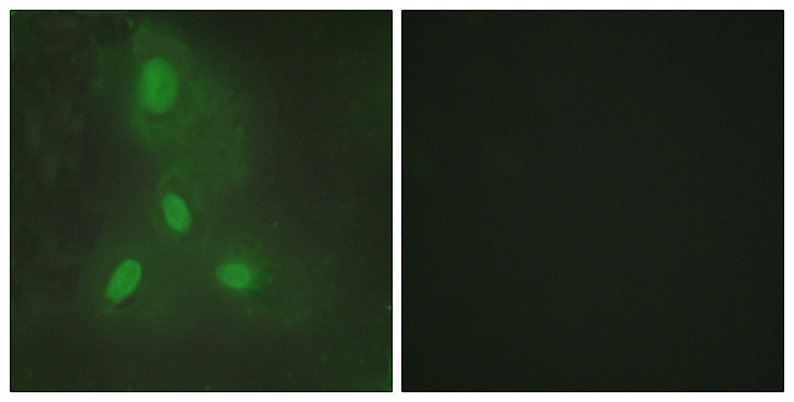 BACH1 Antibody - Immunofluorescence analysis of HeLa cells, using BACH1 Antibody. The picture on the right is blocked with the synthesized peptide.
