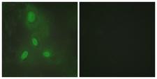 BACH1 Antibody - Immunofluorescence analysis of HeLa cells, using BACH1 Antibody. The picture on the right is blocked with the synthesized peptide.