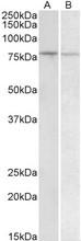 BACH1 Antibody - BACH1 antibody (1 ug/ml) staining of Human Peripheral Blood Lymphocytes (A) and Human Spleen (B) lysate (35 ug protein in RIPA buffer). Primary incubation was 1 hour. Detected by chemiluminescence.
