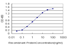BACH1 Antibody - Detection limit for recombinant GST tagged BACH1 is approximately 0.03 ng/ml as a capture antibody.