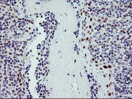 BACH1 Antibody - IHC of paraffin-embedded Human tonsil using anti-BACH1 mouse monoclonal antibody.