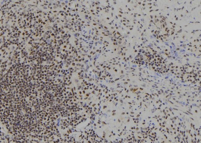 BACH1 Antibody - 1:100 staining human spleen tissue by IHC-P. The sample was formaldehyde fixed and a heat mediated antigen retrieval step in citrate buffer was performed. The sample was then blocked and incubated with the antibody for 1.5 hours at 22°C. An HRP conjugated goat anti-rabbit antibody was used as the secondary.