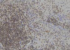 BACH1 Antibody - 1:100 staining human spleen tissue by IHC-P. The sample was formaldehyde fixed and a heat mediated antigen retrieval step in citrate buffer was performed. The sample was then blocked and incubated with the antibody for 1.5 hours at 22°C. An HRP conjugated goat anti-rabbit antibody was used as the secondary.
