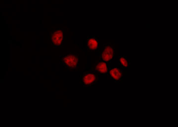 BACH1 Antibody - Staining HepG2 cells by IF/ICC. The samples were fixed with PFA and permeabilized in 0.1% Triton X-100, then blocked in 10% serum for 45 min at 25°C. The primary antibody was diluted at 1:200 and incubated with the sample for 1 hour at 37°C. An Alexa Fluor 594 conjugated goat anti-rabbit IgG (H+L) Ab, diluted at 1/600, was used as the secondary antibody.