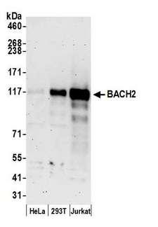BACH2 Antibody - Detection of human BACH2 by western blot. Samples: Whole cell lysate (15 µg) from HeLa, HEK293T, and Jurkat cells prepared using NETN lysis buffer. Antibody: Affinity purified rabbit anti-BACH2 antibody used for WB at 0.1 µg/ml. Detection: Chemiluminescence with an exposure time of 3 minutes.