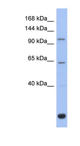 BACH2 Antibody - BACH2 antibody Western blot of Fetal Thymus lysate. This image was taken for the unconjugated form of this product. Other forms have not been tested.