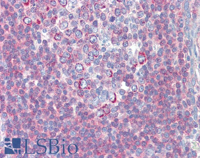 BACH2 Antibody - Anti-BACH2 antibody IHC of human tonsil. Immunohistochemistry of formalin-fixed, paraffin-embedded tissue after heat-induced antigen retrieval. Antibody concentration 2.5 ug/ml.  This image was taken for the unconjugated form of this product. Other forms have not been tested.