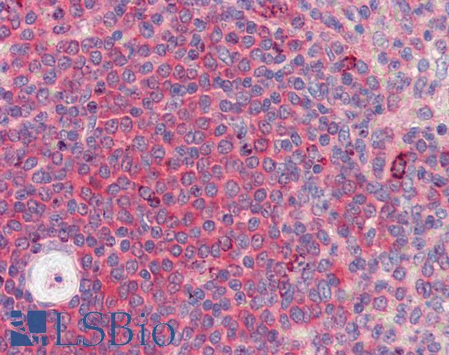 BACH2 Antibody - Anti-BACH2 antibody IHC of human spleen. Immunohistochemistry of formalin-fixed, paraffin-embedded tissue after heat-induced antigen retrieval. Antibody concentration 2.5 ug/ml.  This image was taken for the unconjugated form of this product. Other forms have not been tested.
