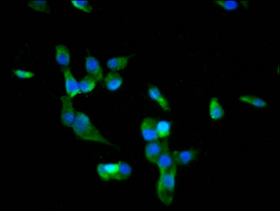 BACH2 Antibody - Immunofluorescence staining of SH-SY5Y cells diluted at 1:66, counter-stained with DAPI. The cells were fixed in 4% formaldehyde, permeabilized using 0.2% Triton X-100 and blocked in 10% normal Goat Serum. The cells were then incubated with the antibody overnight at 4°C.The Secondary antibody was Alexa Fluor 488-congugated AffiniPure Goat Anti-Rabbit IgG (H+L).
