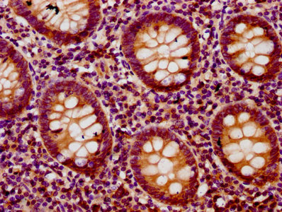 BACH2 Antibody - Immunohistochemistry Dilution at 1:200 and staining in paraffin-embedded human appendix tissue performed on a Leica BondTM system. After dewaxing and hydration, antigen retrieval was mediated by high pressure in a citrate buffer (pH 6.0). Section was blocked with 10% normal Goat serum 30min at RT. Then primary antibody (1% BSA) was incubated at 4°C overnight. The primary is detected by a biotinylated Secondary antibody and visualized using an HRP conjugated SP system.