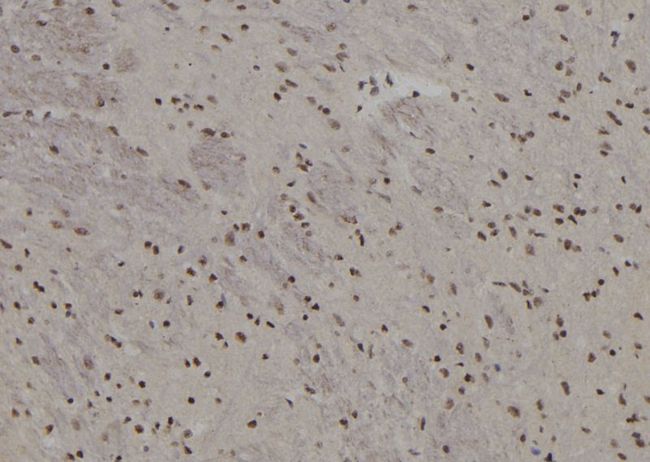 BACH2 Antibody - 1:100 staining rat brain tissue by IHC-P. The sample was formaldehyde fixed and a heat mediated antigen retrieval step in citrate buffer was performed. The sample was then blocked and incubated with the antibody for 1.5 hours at 22°C. An HRP conjugated goat anti-rabbit antibody was used as the secondary.