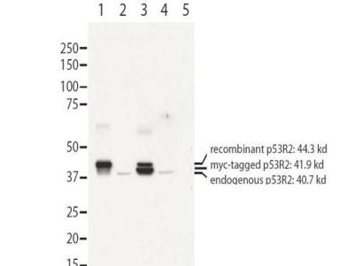 BACH2 Antibody - Western Blot of rabbit anti-Bach2 antibody. Lane 1: 293T cell lysates overexpressing Bach2-Flag. Lane 2: 293T cell lysates. Load: 20 µg per lane. Primary antibody: Bach-2 antibody at 1:1000 for overnight at 4°C. Secondary antibody: rabbit HRP secondary antibody at 1:10,000 for 45 min at RT. Block: 5% BLOTTO overnight at 4°C. Predicted (native)/Observed (over-expressed) size: 91.7 kDa, ~130 kDa for Bach2. Other band(s): none.