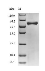 BH0637 Protein - (Tris-Glycine gel) Discontinuous SDS-PAGE (reduced) with 5% enrichment gel and 15% separation gel.