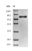 BH0637 Protein - (Tris-Glycine gel) Discontinuous SDS-PAGE (reduced) with 5% enrichment gel and 15% separation gel.