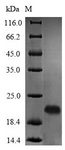 luxS Protein - (Tris-Glycine gel) Discontinuous SDS-PAGE (reduced) with 5% enrichment gel and 15% separation gel.