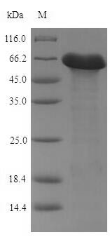 Penicillin-binding protein 4 Protein - (Tris-Glycine gel) Discontinuous SDS-PAGE (reduced) with 5% enrichment gel and 15% separation gel.