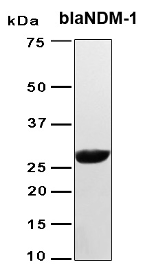 blaNDM-1 / Metallo-beta-Lactam Protein