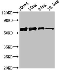 Bacterial alanine dehydrogenase Antibody - Western Blot Positive WB detected in Recombinant protein All lanes: ald1 antibody at 2.4µg/ml Secondary Goat polyclonal to rabbit IgG at 1/50000 dilution predicted band size: 57 kDa observed band size: 57 kDa