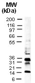 Baculovirus p35 Antibody - Western blot of in vitro translated p35 baculovirus protein using Polyclonal Antibody to p35 baculovirus at 1:2000. Full-length p35 is detected at ~35 kD, lower molecular p35 breakdown/cleavage bands are also detected.