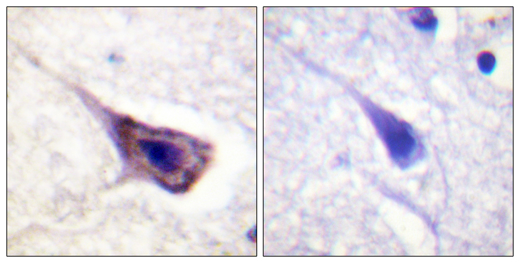 BAD Antibody - Immunohistochemistry analysis of paraffin-embedded human brain tissue, using BAD Antibody. The picture on the right is blocked with the synthesized peptide.