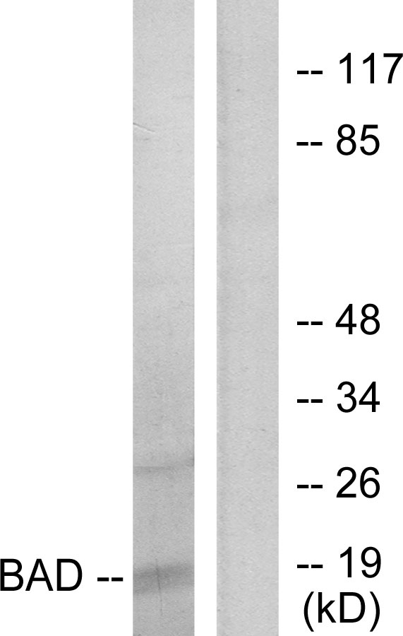 BAD Antibody - Western blot analysis of lysates from 293 cells, treated with Forskolin, using BAD Antibody. The lane on the right is blocked with the synthesized peptide.