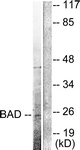 BAD Antibody - Western blot of extracts from 293 cells, treated with Etoposide 25 uM 60', using BAD (Cleaved-Asp71) Antibody. The lane on the right is treated with the synthesized peptide.