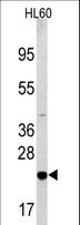 BAD Antibody - Western blot of anti-Bad Antibody in HL60 cell line lysates (35 ug/lane). Bad(arrow) was detected using the purified antibody.