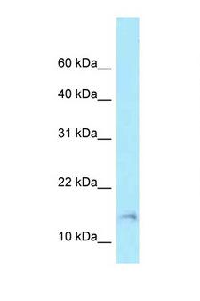 BAD Antibody - BAD antibody Western blot of 721_B Cell lysate. Antibody concentration 1 ug/ml.  This image was taken for the unconjugated form of this product. Other forms have not been tested.