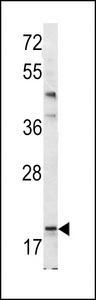 BAD Antibody - Western blot of Bad BH3 Domain antibody in mouse bladder tissue lysates (35 ug/lane). Bad (arrow) was detected using the purified antibody.