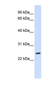 BAD Antibody - BAD antibody Western blot of Fetal Liver lysate. This image was taken for the unconjugated form of this product. Other forms have not been tested.
