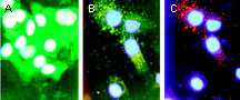 BAD Antibody - Immunofluorescence microscopy of BAD using Polyclonal Antibody to BAD at 1:2000. Du145 human prostate carcinoma cells were cultured without (A) or with (B and C) 1 uM of the triphosphatase inhibitor thapsigargin (THG) for 12 hr. A and B, staining with BAD antibody, followed by a FITC-conjugated secondary antibody. C, staining with a mitochondrial marker (antibody to mitochondrial Hsp60), followed by a rhodamine-conjugated secondary antibody. THG induces Ca2+ release from internal stores which can promote apoptosis. BAD staining was located diffusely throughout the cytoplasm of untreated cells (A), and localized to the mitochondria in treated cells (B).