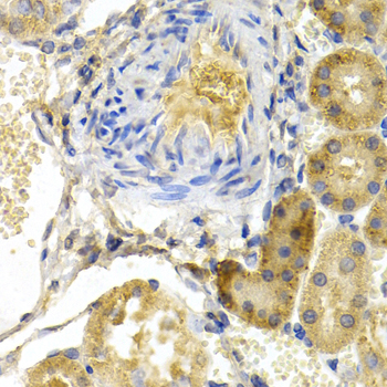 BAD Antibody - Immunohistochemistry of paraffin-embedded rat kidney using BAD antibodyat dilution of 1:200 (40x lens).