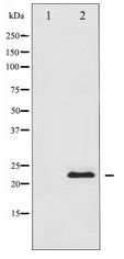 BAD Antibody - Western blot of BAD expression in Forskolin treated 293 whole cell lysates,The lane on the left is treated with the antigen-specific peptide.