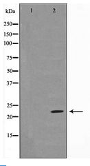 BAD Antibody - Western blot of BAD expression in Forskolin treated 293 whole cell lysates,The lane on the left is treated with the antigen-specific peptide.