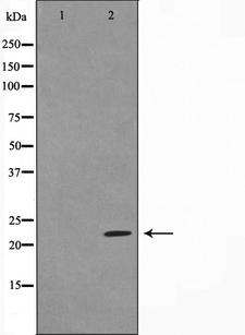 BAD Antibody - Western blot analysis of BAD expression in Forskolin treated 293 whole cells lysates. The lane on the left is treated with the antigen-specific peptide.