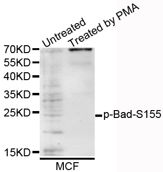BAD Antibody - Western blot analysis of extracts of various cells.