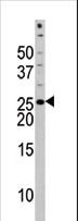 BAD Antibody - The anti-Phospho-Bad-S118 antibody is used in Western blot to detect Phospho-Bad-S118 in HL60 tissue lysate